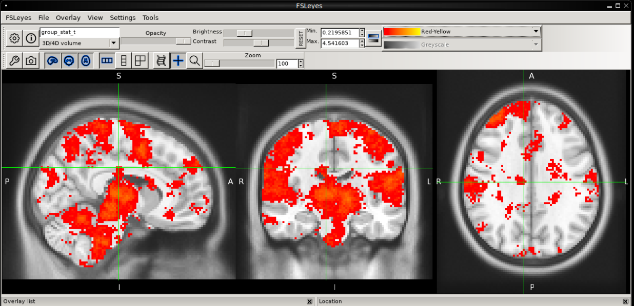 Brain Imaging